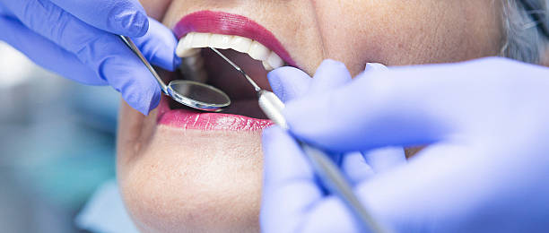 Best Emergency Dental Care for Sports Injuries in Gunnison, UT