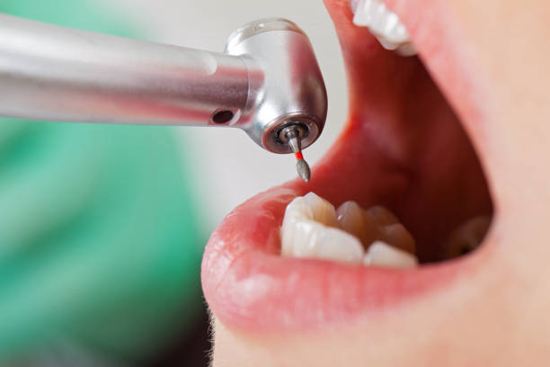 Professional Emergency Dental Service in UT
